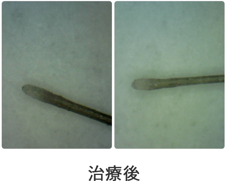 治療後の写真