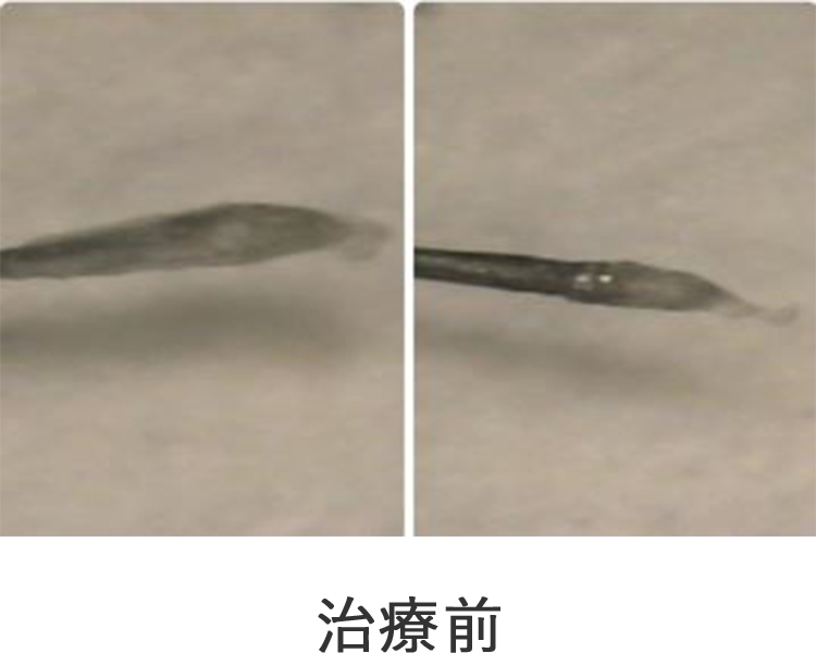 治療前の写真